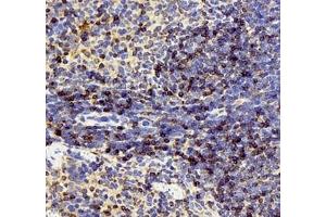 Immunohistochemistry of paraffin embedded mouse spleen using IL-2 Receptor alpha (ABIN7074349) at dilution of 1: 200 (400x lens)