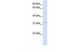 Image no. 1 for anti-Voltage-Dependent Anion Channel 2 (VDAC2) (AA 38-87) antibody (ABIN6737761)