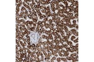 Immunohistochemical staining of human liver with MITD1 polyclonal antibody  shows strong cytoplasmic positivity in hepatocytes at 1:20-1:50 dilution. (MITD1 抗体)