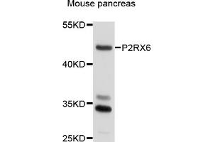 Western blot analysis of extracts of mouse pancreas, using P2RX6 antibody (ABIN6003829) at 1/1000 dilution. (P2RX6 抗体)