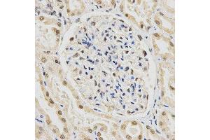 Immunohistochemistry (IHC) image for anti-Small Nuclear Ribonucleoprotein Polypeptide E (SNRPE) antibody (ABIN1876676) (SNRPE 抗体)