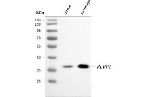 Western blot analysis of RLBP1 using anti-RLBP1 antibody (ABIN7601185).