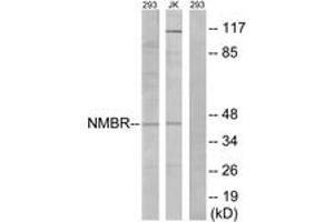 Western blot analysis of extracts from 293/Jurkat cells, using NMBR Antibody. (NMBR 抗体  (AA 221-270))