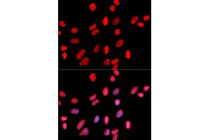 Immunofluorescence (IF) image for anti-Hepatoma-Derived Growth Factor (HDGF) antibody (ABIN1876535) (HDGF 抗体)