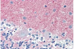 Human Brain, Cerebellum (formalin-fixed, paraffin-embedded) stained with THY1 antibody ABIN396935 at 10 ug/ml followed by biotinylated anti-mouse IgG secondary antibody ABIN481714, alkaline phosphatase-streptavidin and chromogen. (CD90 抗体)