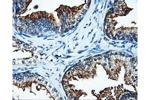 Immunohistochemical staining of paraffin-embedded Kidney tissue using anti-SATB1mouse monoclonal antibody. (SATB1 抗体)
