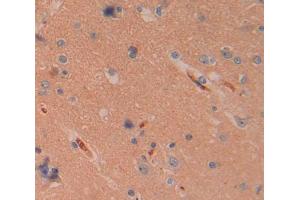 IHC-P analysis of Human Tissue, with DAB staining. (CELA1 抗体  (AA 40-258))