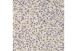 Immunohistochemistry of paraffin-embedded human amygdalitis using ANP32A Antibody (ABIN5973390) at dilution of 1/100 (40x lens). (PHAP1 抗体)