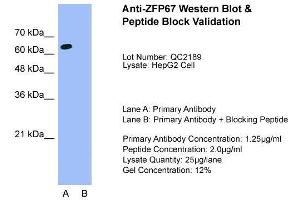 Western Blotting (WB) image for anti-Zinc Finger and BTB Domain Containing 7B (ZBTB7B) (Middle Region) antibody (ABIN2777563)