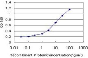 Detection limit for recombinant GST tagged IRAK3 is approximately 0. (IRAK3 抗体  (AA 497-596))