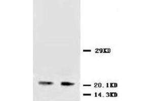 Western blot analysis of rat brain tissue lysis using NT3 antibody (Neurotrophin 3 抗体  (Middle Region))