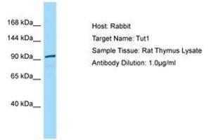 Image no. 1 for anti-Terminal Uridylyl Transferase 1, U6 SnRNA-Specific (TUT1) (N-Term) antibody (ABIN6749859) (TUT1 抗体  (N-Term))