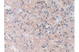 Detection of MMP3 in Human Appendix Tissue using Monoclonal Antibody to Matrix Metalloproteinase 3 (MMP3)