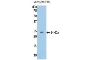 Western Blotting (WB) image for anti-Insulin-Like Growth Factor Binding Protein 6 (IGFBP6) (AA 31-240) antibody (ABIN1859312) (IGFBP6 抗体  (AA 31-240))