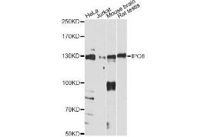 Western blot analysis of extracts of various cell lines, using IPO8 antibody.