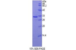 SDS-PAGE (SDS) image for Hyaluronan Synthase 1 (HAS1) (AA 164-421) protein (His tag) (ABIN1878431)