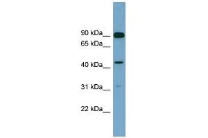 WB Suggested Anti-DGKA Antibody Titration: 0. (DGKA 抗体  (N-Term))