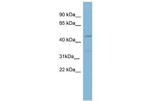 Matrilin 1 antibody used at 1 ug/ml to detect target protein. (MATN1 抗体  (Middle Region))