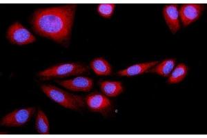 IF analysis of SRP72 using anti-SRP72 antibody (ABIN7601648). (SRP72 抗体  (AA 40-460))