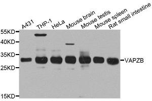 Western blot analysis of extracts of various cell lines, using CAPZB antibody. (CAPZB 抗体  (AA 1-272))