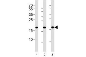 Western blot analysis of lysate from HepG2, NCCIT, mouse NIH3T3 cell line (left to right) using HMGA2 antibody (HMGA2 抗体  (N-Term))
