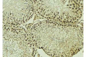 ABIN6269325 at 1/100 staining Mouse testis tissue by IHC-P. (PKC zeta 抗体  (C-Term))