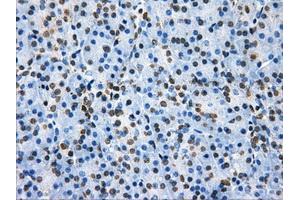 Immunohistochemical staining of paraffin-embedded colon tissue using anti-HDAC10mouse monoclonal antibody. (HDAC10 抗体)