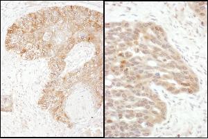 Immunohistochemistry (IHC) image for anti-TS (C-Term) antibody (ABIN7795593) (TS (C-Term) 抗体)