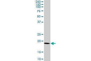 ARF5 monoclonal antibody (M01), clone 1B4. (ARF5 抗体  (AA 81-180))