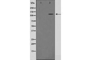 Western blot analysis on HeLa cell lysate using CARD6 Antibody,The lane on the left is treated with the antigen-specific peptide. (CARD6 抗体  (N-Term))