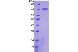 Image no. 1 for Fucosyltransferase 8 (Alpha (1,6) Fucosyltransferase) (FUT8) (AA 206-575) protein (His tag) (ABIN6237380) (FUT8 Protein (AA 206-575) (His tag))