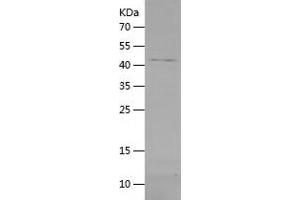 DNMT3A Protein (AA 692-912) (His-IF2DI Tag)