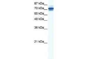 WB Suggested Anti-ZNF690 Antibody Titration:  0. (ZSCAN29 抗体  (Middle Region))