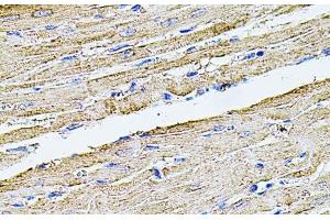 Immunohistochemistry of paraffin-embedded Rat heart using FLNB Polyclonal Antibody at dilution of 1:100 (40x lens). (FLNB 抗体)