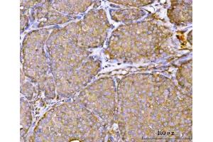 IHC analysis of RPL36 using anti-RPL36 antibody (ABIN7602917).