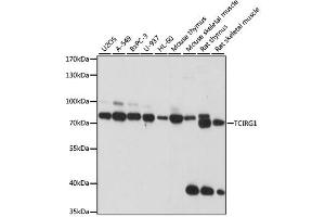 Western blot analysis of extracts of various cell lines, using TCIRG1 antibody. (TCIRG1 抗体)