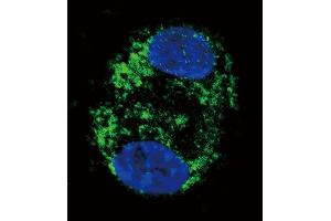 Confocal immunofluorescent analysis of CPT2 Antibody (C-term) (ABIN389105 and ABIN2839295) with HepG2 cell followed by Alexa Fluor 488-conjugated goat anti-rabbit lgG (green). (CPT2 抗体  (C-Term))