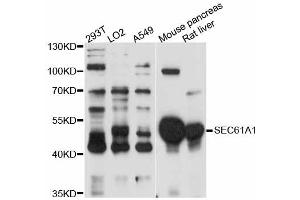 Western blot analysis of extracts of various cell lines, using SEC61A1 antibody. (SEC61A1 抗体)