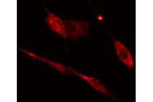 ABIN6274770 staining HeLa cells by IF/ICC. (RPL17 抗体  (C-Term))