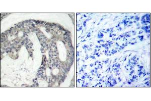 Immunohistochemistry (IHC) image for anti-Nitric Oxide Synthase 3 (Endothelial Cell) (NOS3) (pSer1177) antibody (ABIN1870485) (ENOS 抗体  (pSer1177))