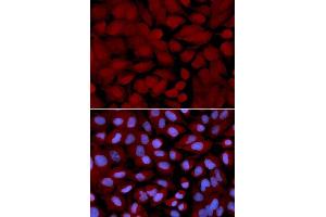 Immunofluorescence analysis of U2OS cells using OGT antibody. (OGT 抗体  (AA 857-1036))