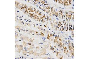 Immunohistochemistry of paraffin-embedded human stomach using BTRC antibody at dilution of 1:200 (x400 lens) (BTRC 抗体  (AA 50-340))