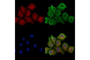 ABIN6264031 and ABIN6278306 staining Hela cells by IF/ICC. (PANX1 抗体  (Internal Region))