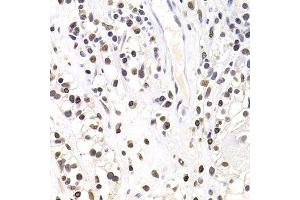 Immunohistochemistry (Paraffin-embedded Sections) (IHC (p)) image for anti-SRY (Sex Determining Region Y)-Box 5 (SOX5) (AA 1-120) antibody (ABIN6148303)