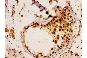 Immunohistochemistry of paraffin-embedded human testis tissue using ABIN7174468 at dilution of 1:100 (UBE2L3 抗体  (AA 1-154))