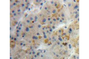 Used in DAB staining on fromalin fixed paraffin-embedded liver tissue (Diazepam Binding Inhibitor 抗体  (AA 1-104))