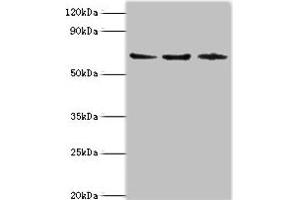 Western blot All lanes: ACAD9 antibody at 6 μg/mL Lane 1: MCF-7 whole cell lysate Lane 2: 293T whole cell lysate Lane 3: K562 whole cell lysate Secondary Goat polyclonal to rabbit IgG at 1/10000 dilution Predicted band size: 69 kDa Observed band size: 69 kDa (ACAD9 抗体  (AA 1-270))