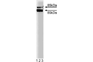 Western blot analysis of Cortactin on a A431 lysate. (Cortactin 抗体)