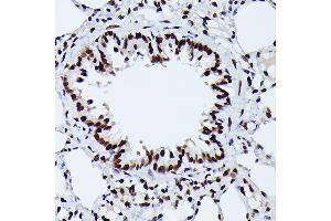 Immunohistochemistry of paraffin-embedded rat lung using Phospho-NRF2-S40 Rabbit mAb (ABIN7268970) at dilution of 1:100 (40x lens). (NRF2 抗体  (pSer40))