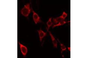 ABIN6275302 staining Hela by IF/ICC. (Neurocan 抗体  (Internal Region))